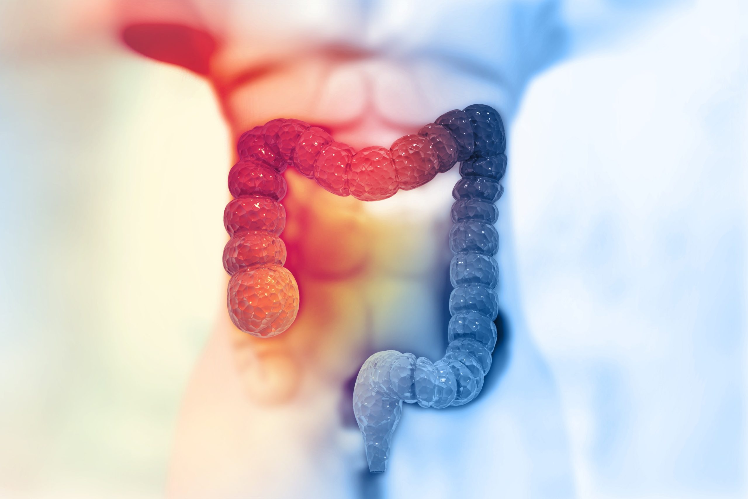 Chondroitin and Glucosamine Protect Against Colorectal Cancer