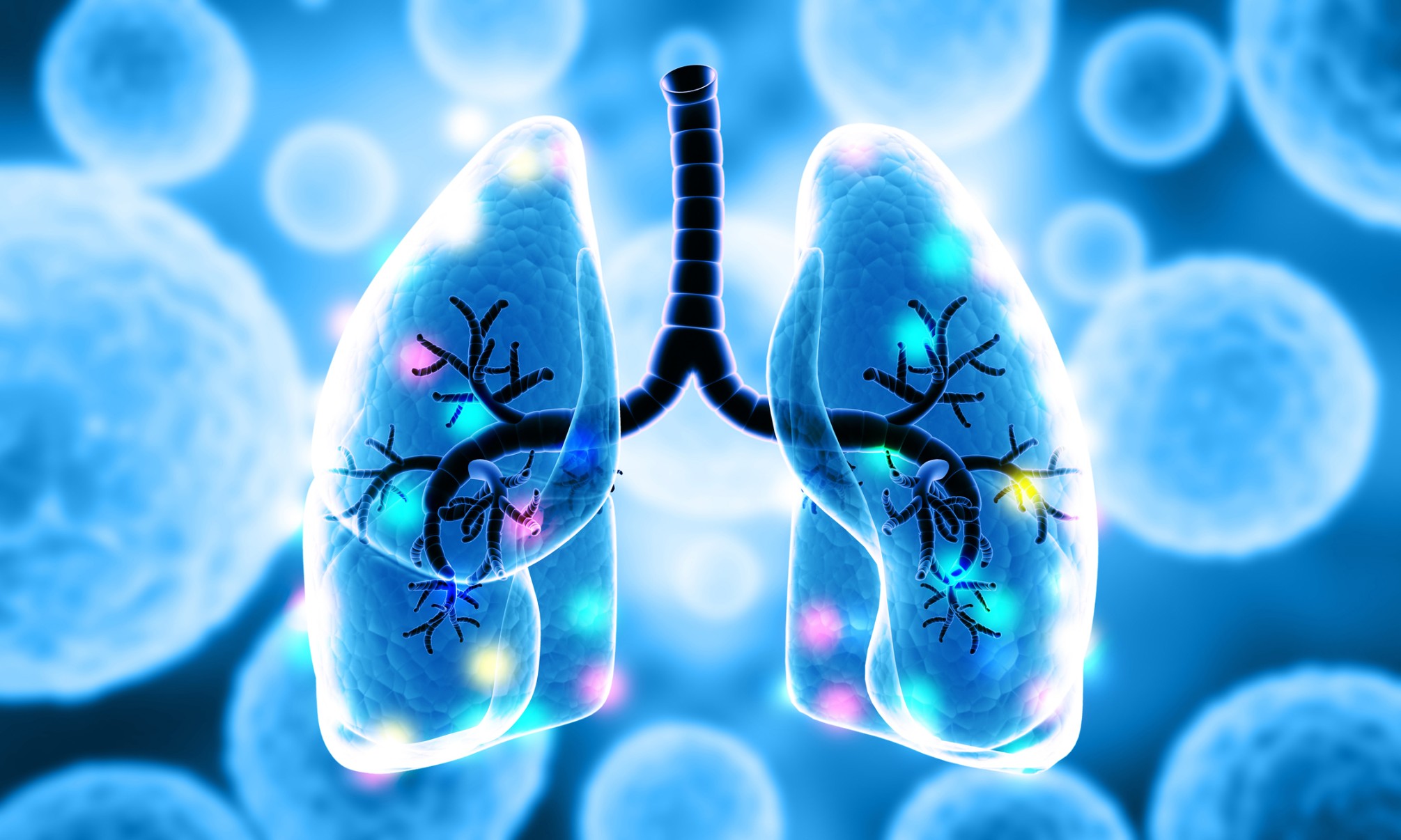 Vitamin D and Lung Cancer!
