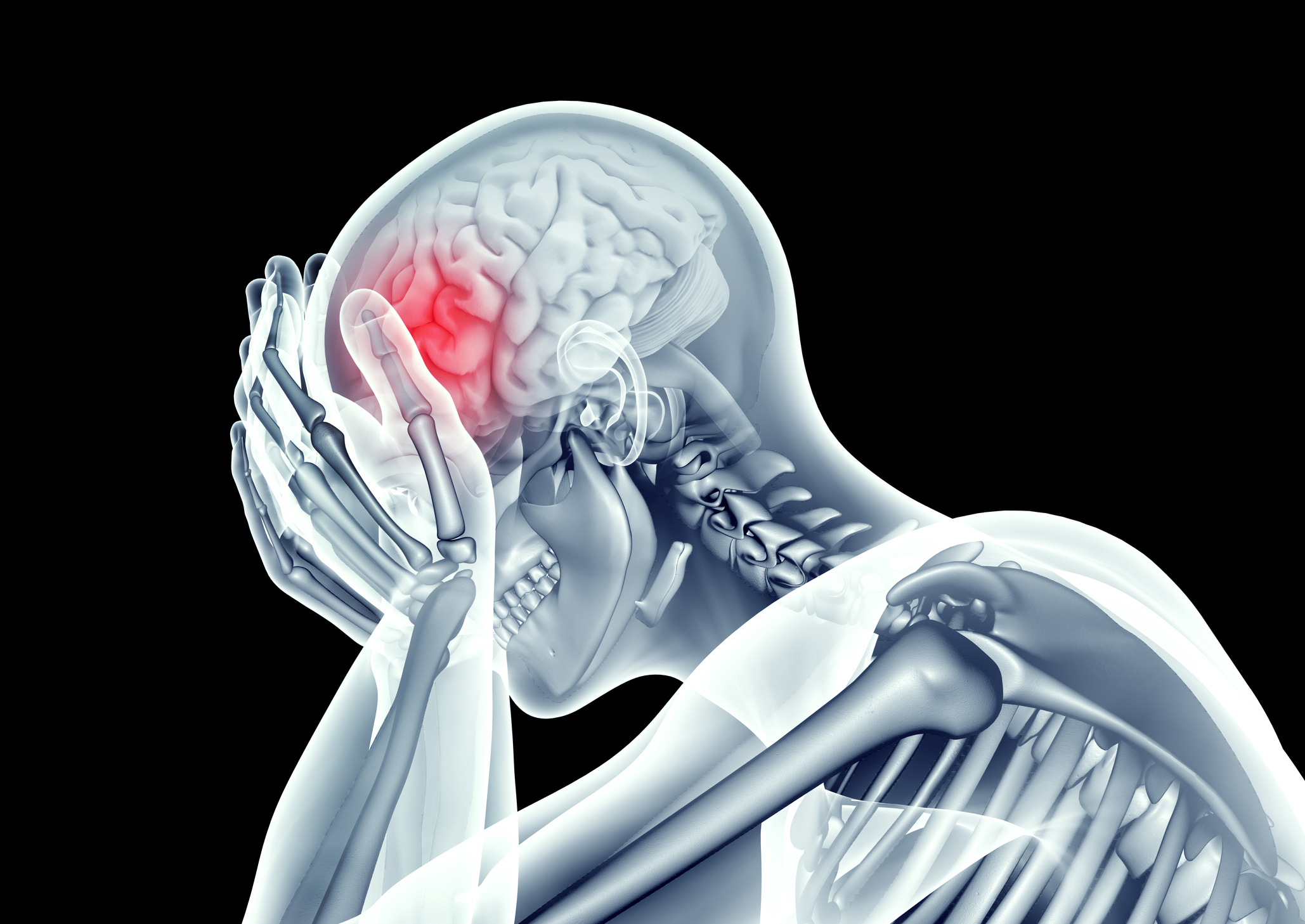 Microglia Activation, the Core Process in Neuroinflammation?