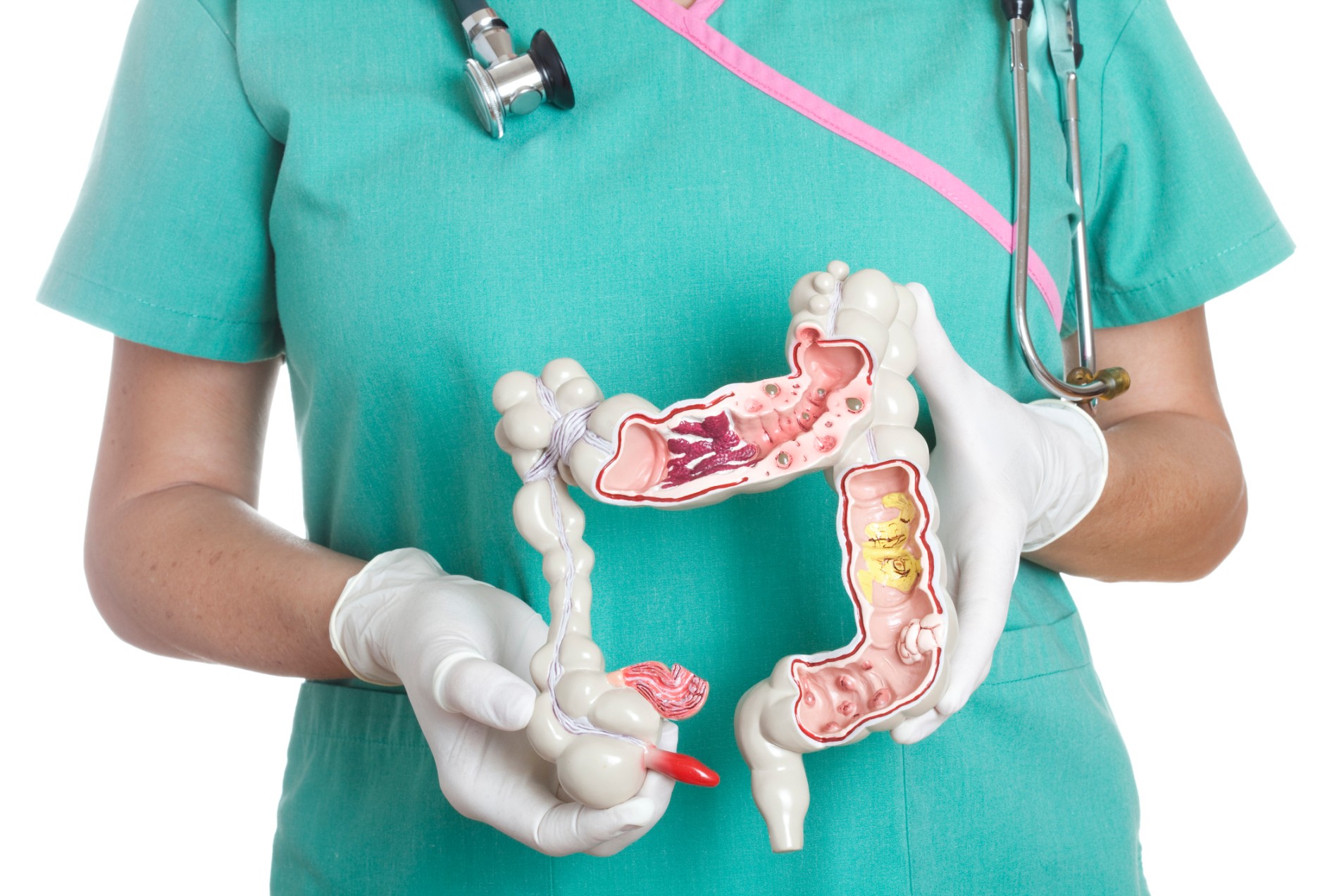 Vitamin D Receptor, Dysbiosis and Intestinal Microbiome Function