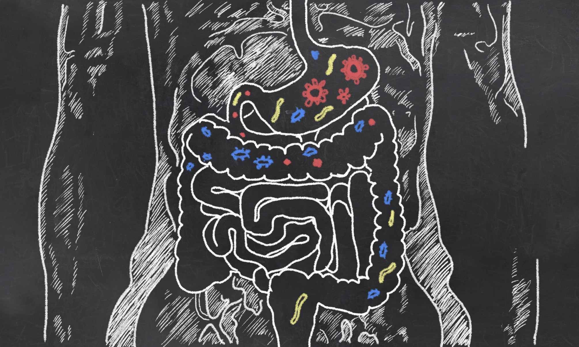 Diabetes in the Gut