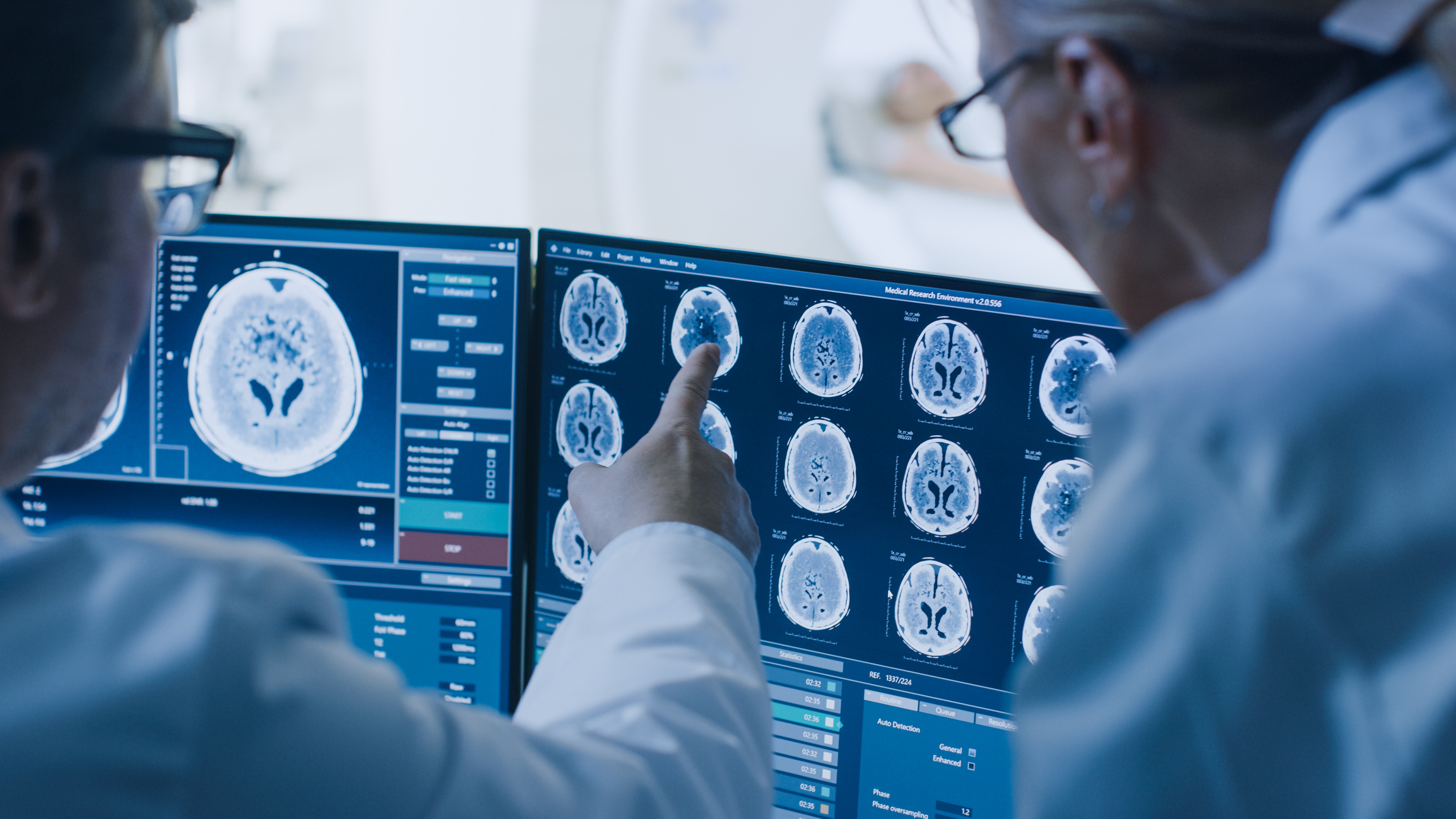 New Study Reveals How Cannabidiol Alters Brain Activity