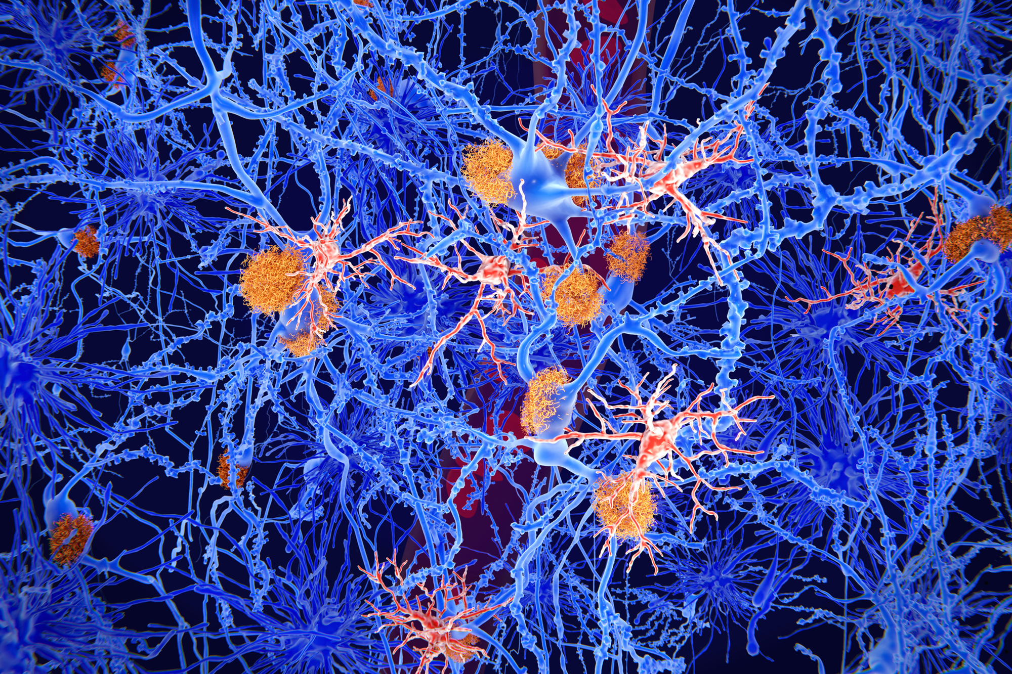 Regenerating the Brain’s Immune System Boosts Memory