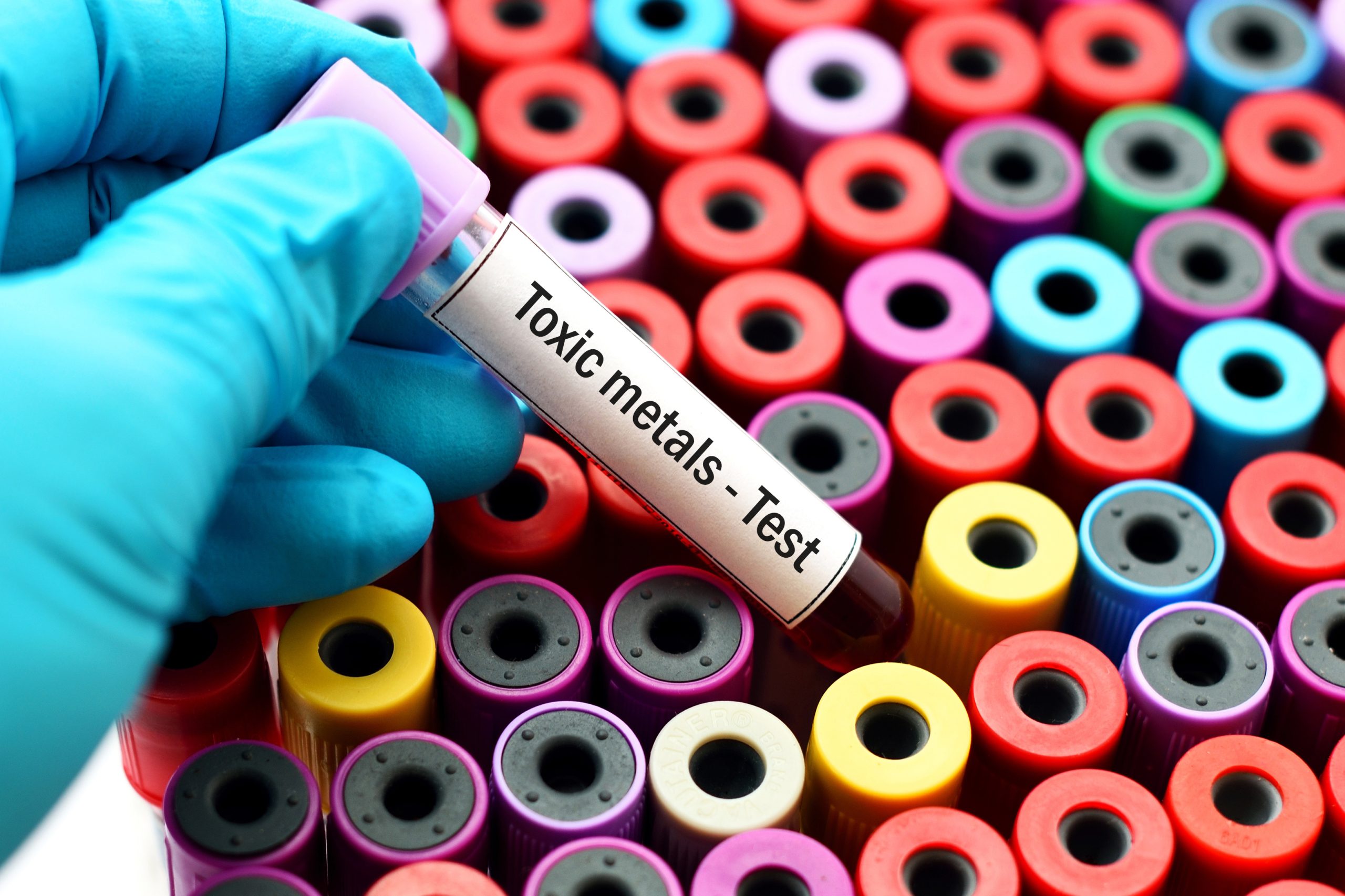 Widespread Lead Exposure in US