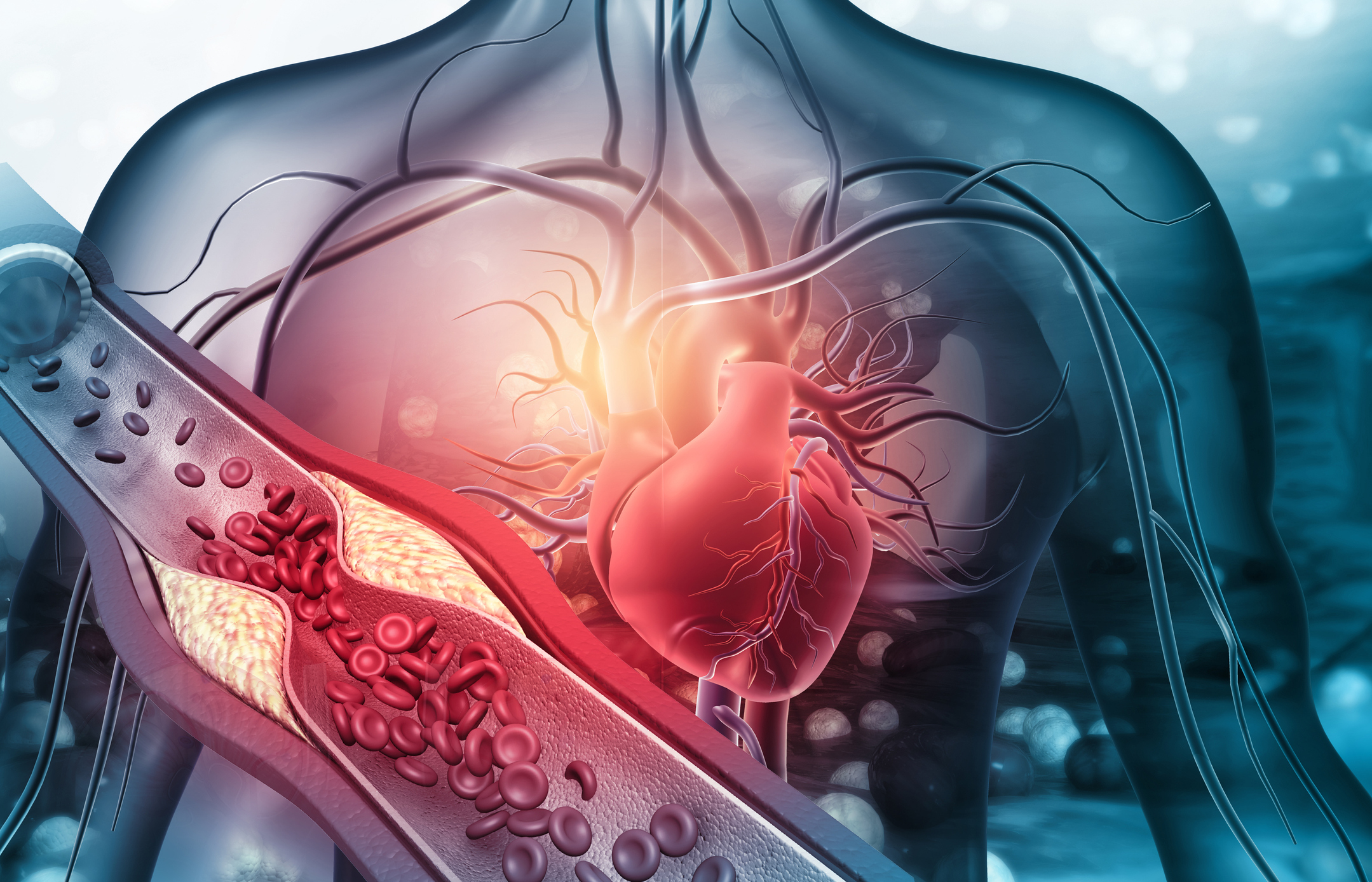 Potentially New LDL Phenotype
