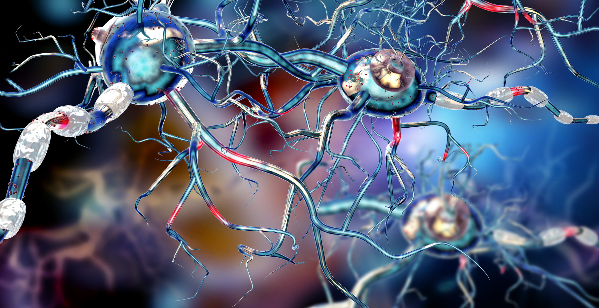 Taking a Look at Huntington’s Disease