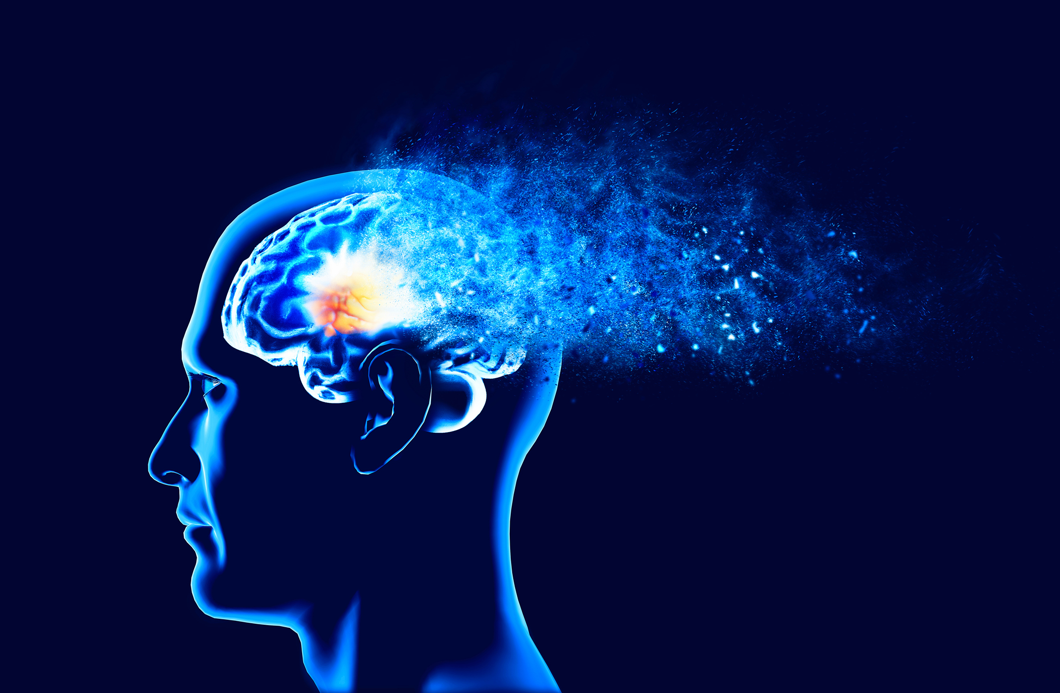 Acid Suppression & Dementia