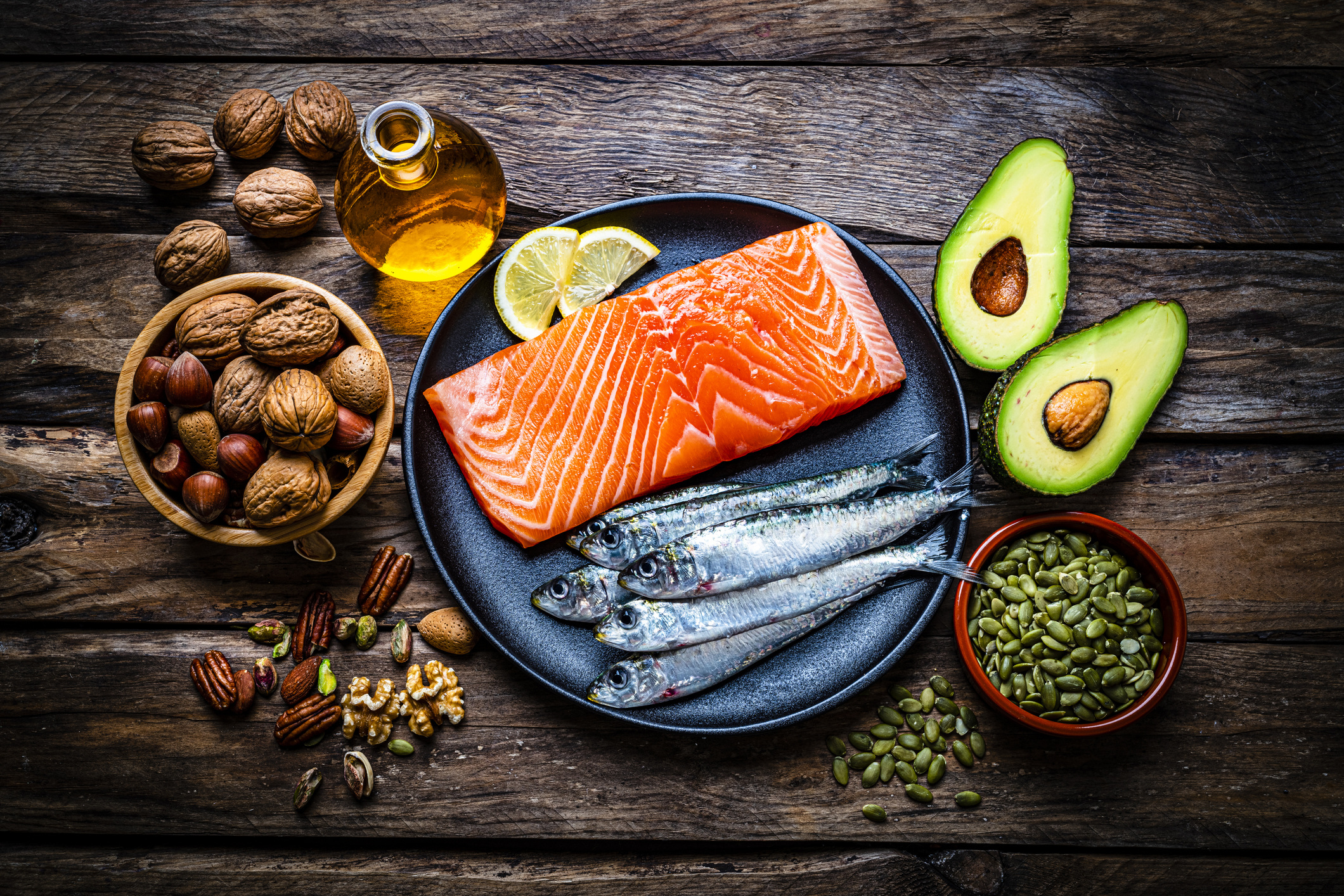 Omega-3s & Neuronal Integrity