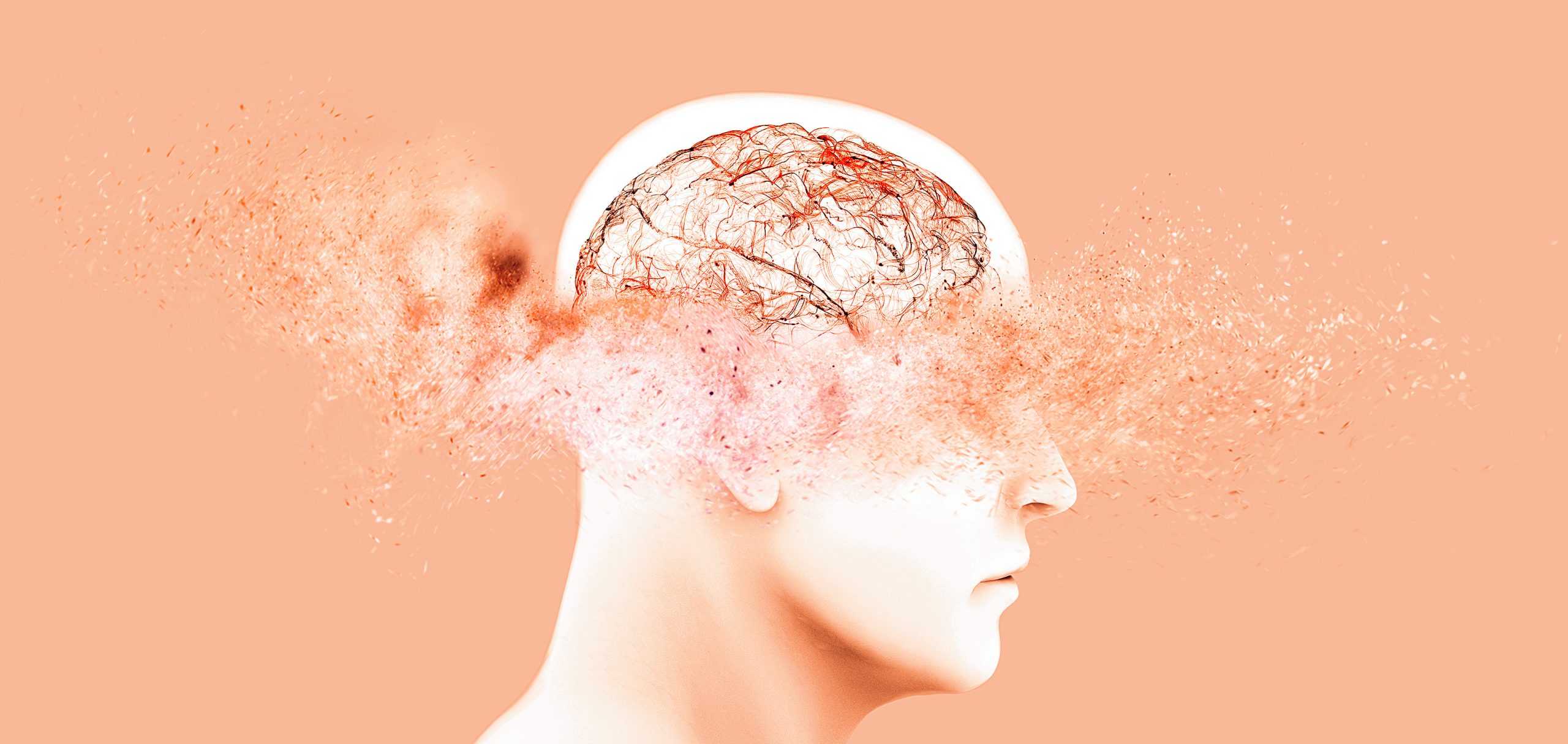 Flavonoids & Dementia